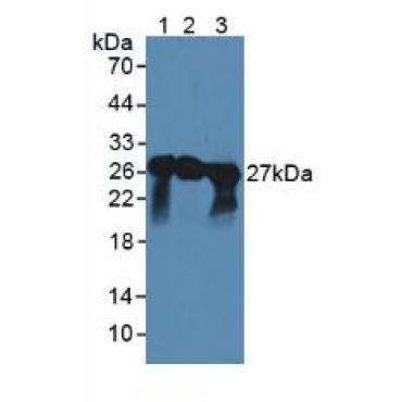 Synaptosomal Associated Protein 25kDa (SNAP25) Human, Mouse, Rat, Pig Polyclonal Antibody