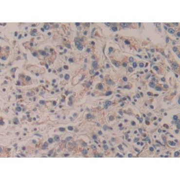 Amyloid Beta Precursor Protein Binding Protein A2 (APBA2) Human Polyclonal Antibody