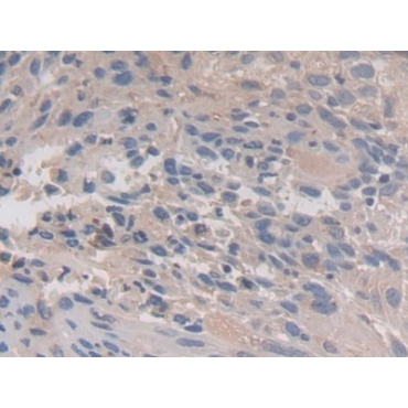 Calpain 3 (CAPN3) Human Polyclonal Antibody