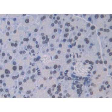 Cathepsin C (CTSC) Mouse Polyclonal Antibody