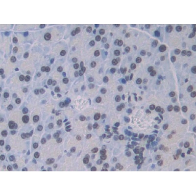Cathepsin C (CTSC) Mouse Polyclonal Antibody