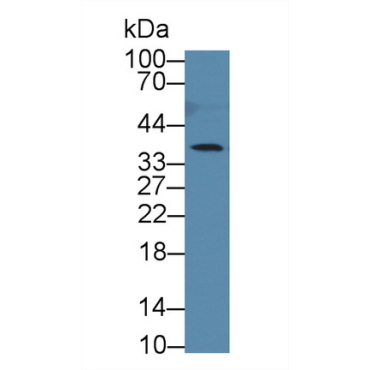 Cathepsin Z (CTSZ) Human Polyclonal Antibody