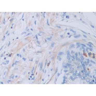 Cathepsin V (CTSV) Human Polyclonal Antibody