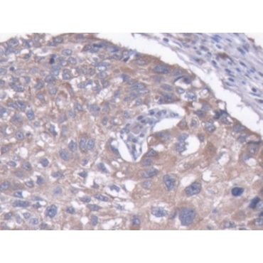 Microtubule Associated Protein 1B (MAP1B) Human Polyclonal Antibody