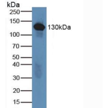 Complement Component 6 (C6) Human Polyclonal Antibody