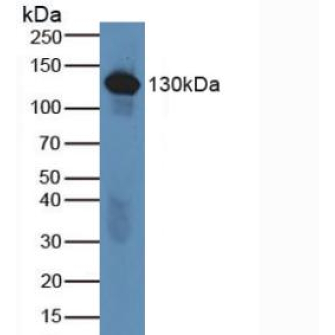 Complement Component 6 (C6) Human Polyclonal Antibody