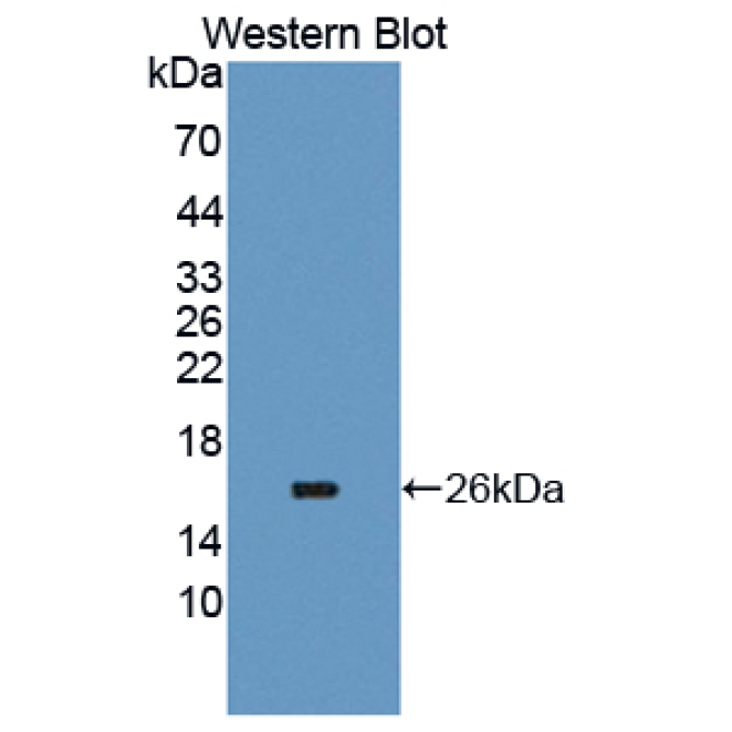 Carcinoembryonic Antigen Related Cell Adhesion Molecule 6 (CEACAM6) Human Polyclonal Antibody