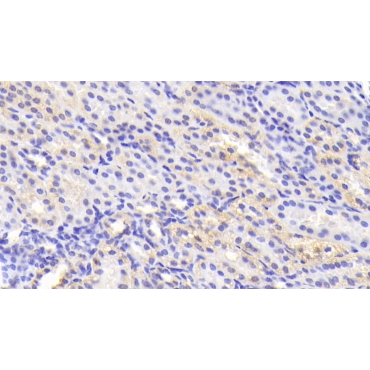 Tankyrase 2 (TNKS2) Human Polyclonal Antibody