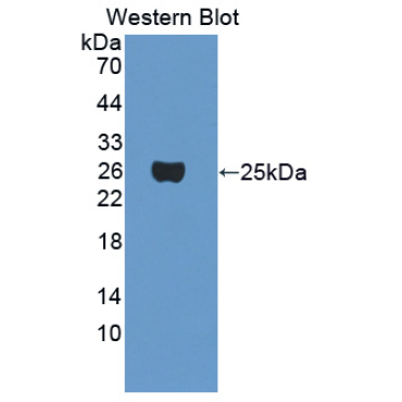 Crystallin Gamma F (CRYgF) Mouse Polyclonal Antibody