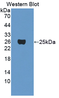 Crystallin Gamma F (CRYgF) Mouse Polyclonal Antibody