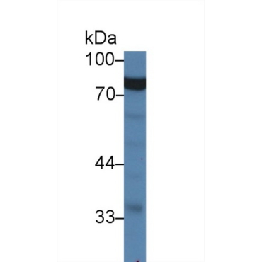 Glycyl tRNA Synthetase (GARS) Human Polyclonal Antibody