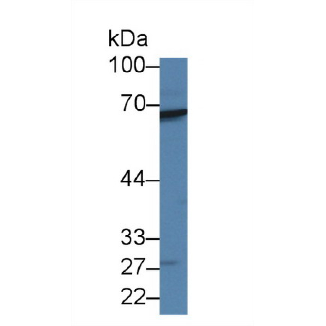 Arginyl tRNA Synthetase (RARS) Human Polyclonal Antibody
