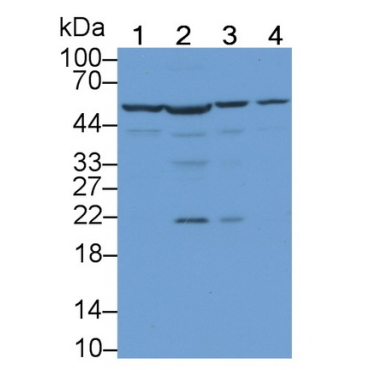 Histidyl tRNA Synthetase (HARS) Human Polyclonal Antibody