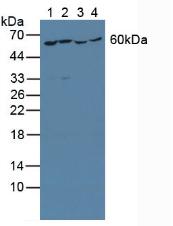 Tyrosyl tRNA Synthetase (YARS) Human Polyclonal Antibody
