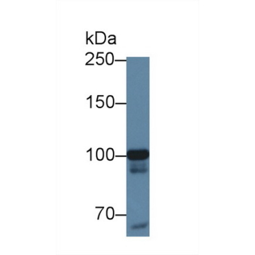 Methionyl tRNA Synthetase (MARS) Human Polyclonal Antibody