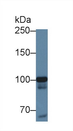 Methionyl tRNA Synthetase (MARS) Human Polyclonal Antibody