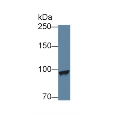 Methionyl tRNA Synthetase (MARS) Mouse Polyclonal Antibody
