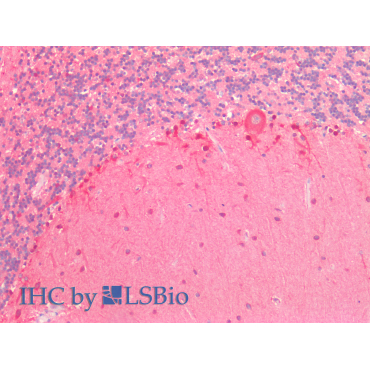 Valyl tRNA Synthetase (VARS) Human Polyclonal Antibody