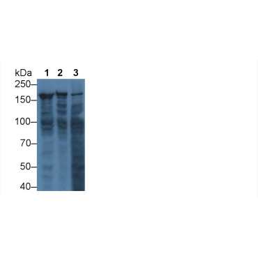 Glutamyl Prolyl tRNA Synthetase (EPRS) Human Polyclonal Antibody