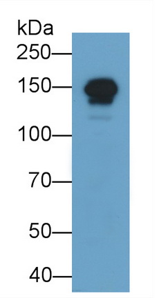 Myosin Binding Protein C, Cardiac (MYBPC3) Human Polyclonal Antibody
