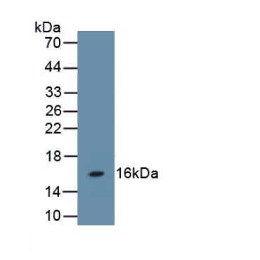 Follicle Stimulating Hormone Beta (FSHb) Human Polyclonal Antibody