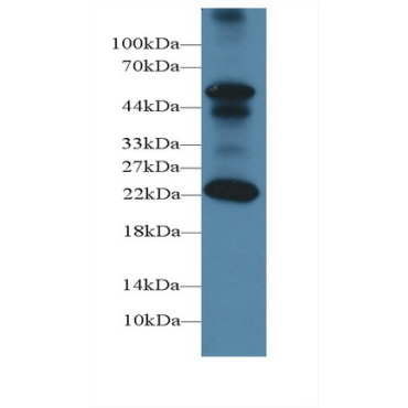 Follicle Stimulating Hormone Beta (FSHb) Mouse Polyclonal Antibody