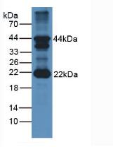 Follicle Stimulating Hormone Beta (FSHb) Pig Polyclonal Antibody