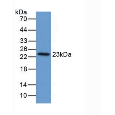 Ferritin, Light Polypeptide (FTL) Bovine (Cattle) Polyclonal Antibody