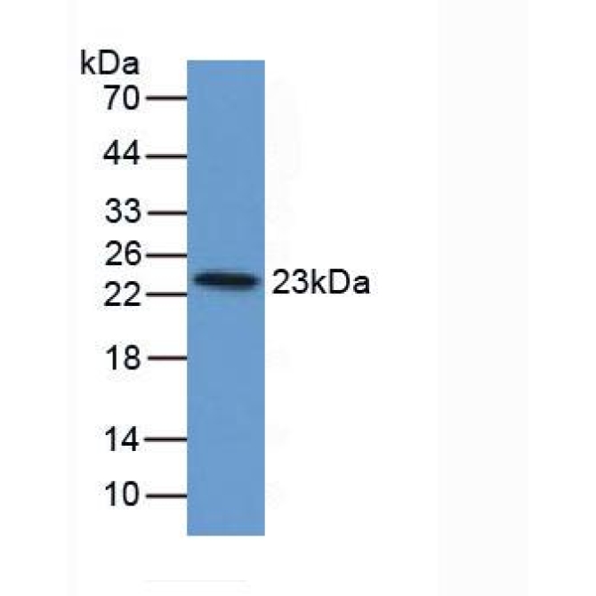Ferritin, Light Polypeptide (FTL) Bovine (Cattle) Polyclonal Antibody