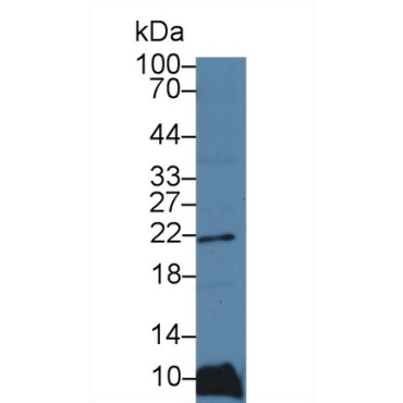 Ferritin, Light Polypeptide (FTL) Human Polyclonal Antibody