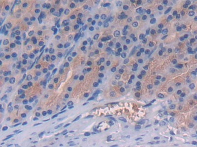Fibrinogen Like Protein 1 (FGL1) Rat Polyclonal Antibody