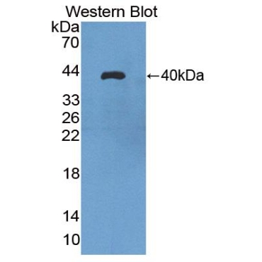 Aquaporin 8 (AQP8) Human Polyclonal Antibody