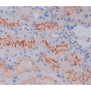 Calcium/Calmodulin Dependent Protein Kinase I (CAMK1) Human Polyclonal Antibody