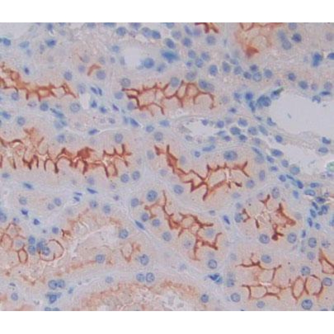 Calcium/Calmodulin Dependent Protein Kinase I (CAMK1) Human Polyclonal Antibody