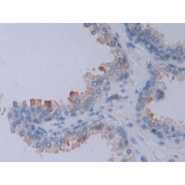 Neuropilin 2 (NRP2) Human Polyclonal Antibody