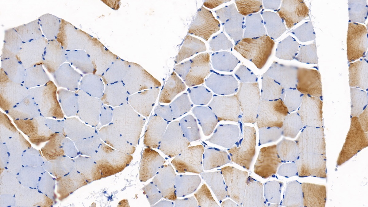Neuropilin 2 (NRP2) Rat Polyclonal Antibody