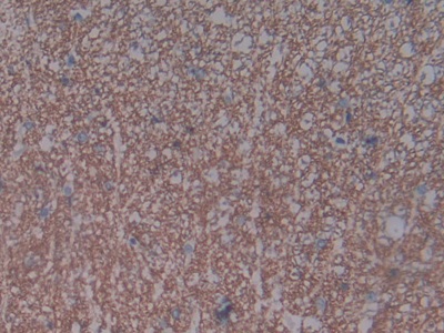 Natriuretic Peptide Receptor 3 (NPR3) Rat Polyclonal Antibody