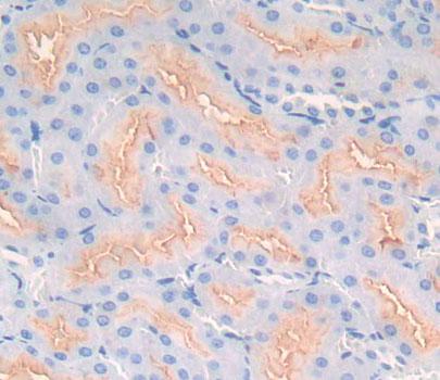 Neutral Sphingomyelinase (NSMASE) Rat Polyclonal Antibody