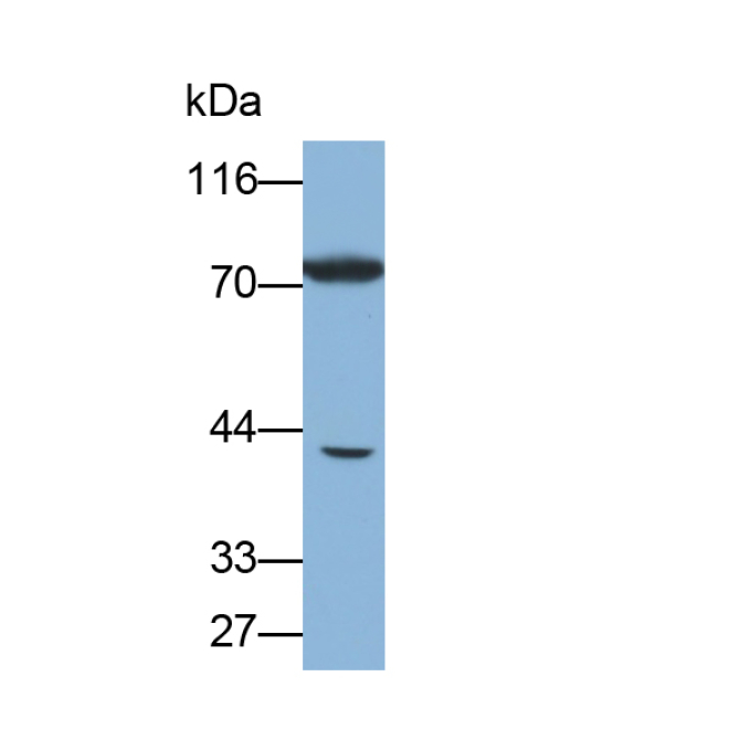 Heat Shock 70kDa Protein 6 (HSPA6) Human Polyclonal Antibody