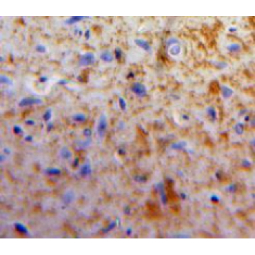Apelin (APLN) Human Polyclonal Antibody