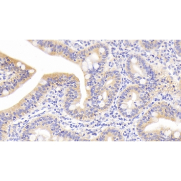 Membrane Protein, Palmitoylated 3 (MPP3) Human Polyclonal Antibody
