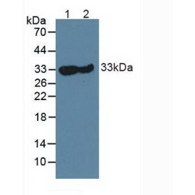 Carbonic Anhydrase III, Muscle Specific (CA3) Human Polyclonal Antibody