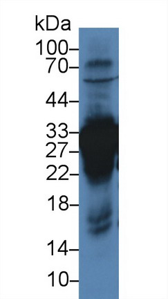 Carbonic Anhydrase III, Muscle Specific (CA3) Rat Polyclonal Antibody