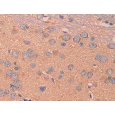 Carbonic Anhydrase VB, Mitochondrial (CA5B) Mouse Polyclonal Antibody