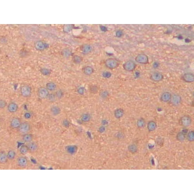 Carbonic Anhydrase VB, Mitochondrial (CA5B) Mouse Polyclonal Antibody