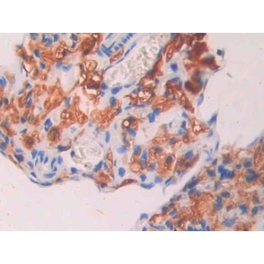 Carbonic Anhydrase VII (CA7) Mouse Polyclonal Antibody