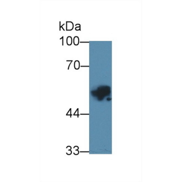 Carbonic Anhydrase IX (CA9) Human Polyclonal Antibody