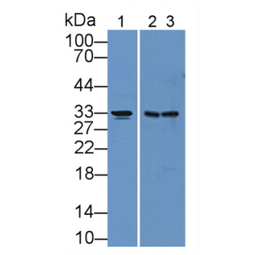 Carbonic Anhydrase XII (CA12) Human Polyclonal Antibody