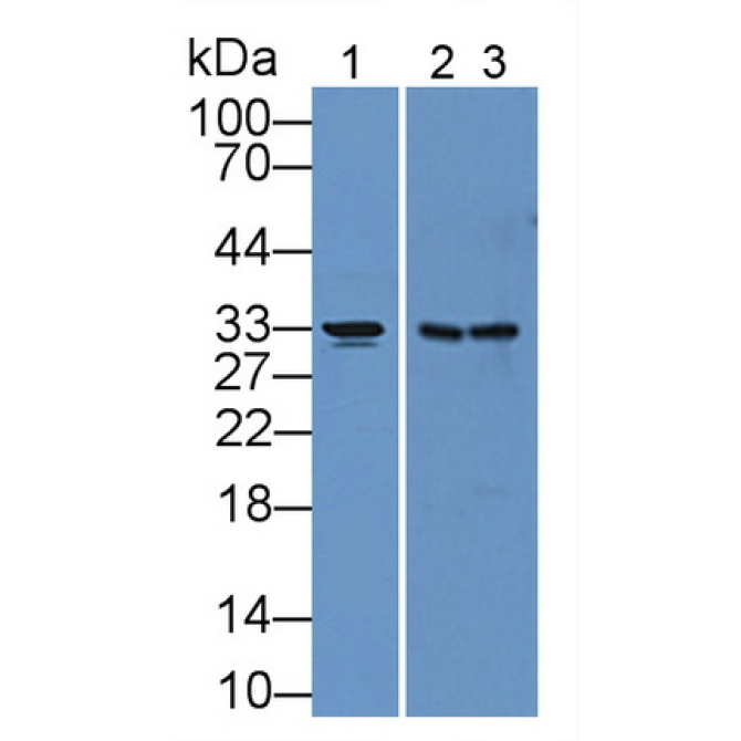 Carbonic Anhydrase XII (CA12) Human Polyclonal Antibody