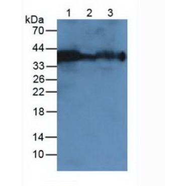 Carbonic Anhydrase XII (CA12) Mouse Polyclonal Antibody